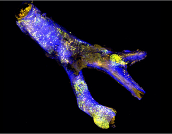 The carotid artery of a mouse with artherosclerosis