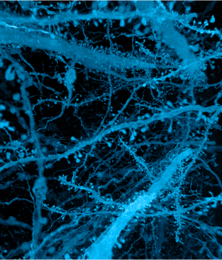 A forest of nerve cells in the brain
