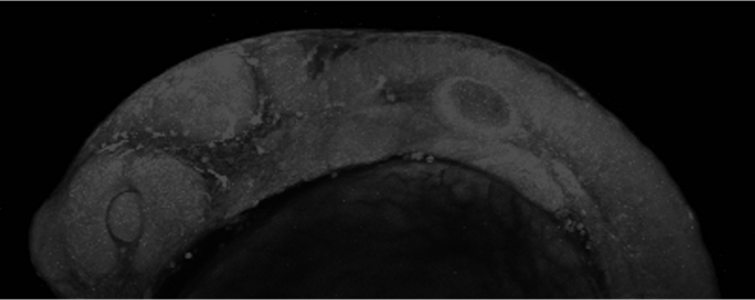 A zebrafish embryo at one day old