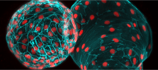 Heart muscle membrane and its nuclei of zebrafish heart