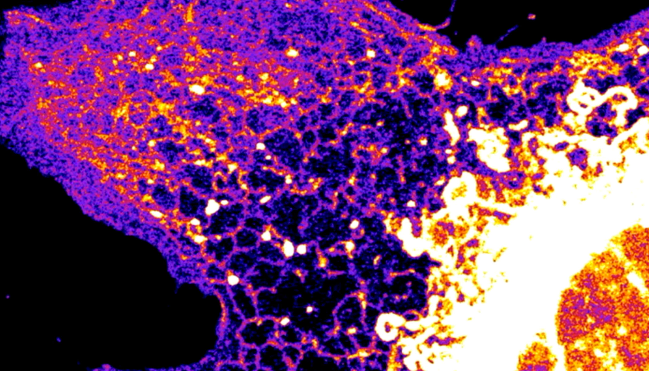 A purple and pink fibroblast cell is displayed against a black background.