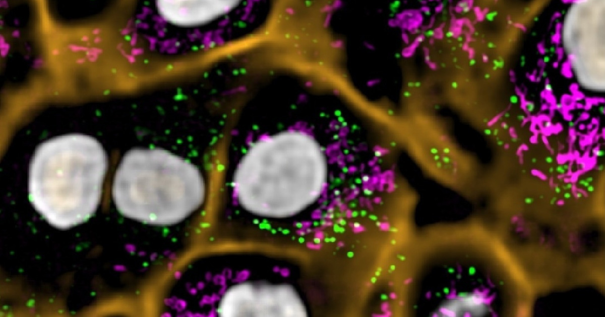 Fluorescent microscopy image showing cell structures with highlighted organelles in green, magenta, and orange.